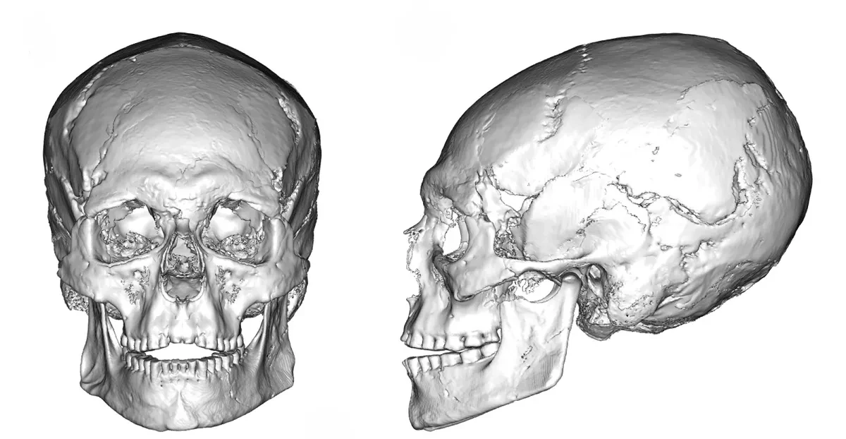 Cranio